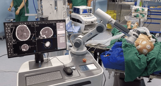 贵州水矿总医院微创脑科中心:机器人脑立体定向技术让患者回归正常生活!