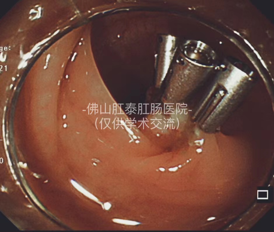 20250529171402441950.jpg 微信图片_20230607083105.jpg