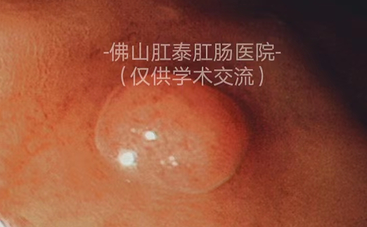 20251026165745955899.png image.png