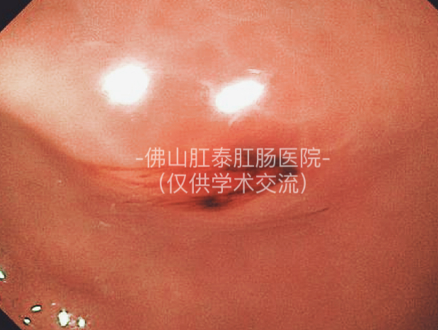 20251213153414120837.png image.png