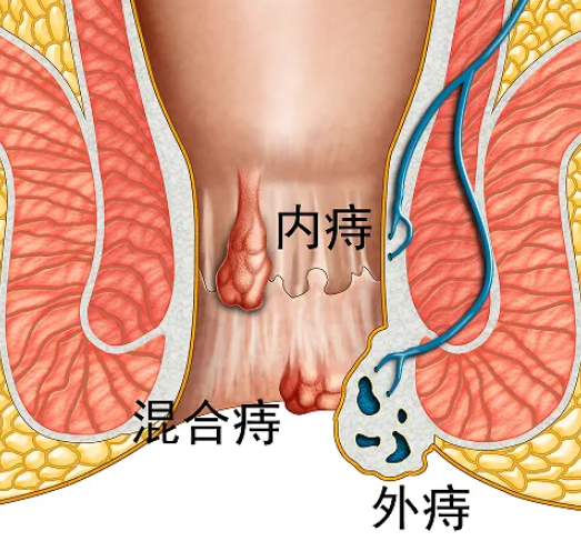 20260108170232359550.png image.png