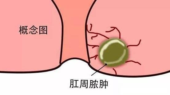 timg (1)