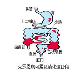 u=535763235,2700633027&fm=26&gp=0