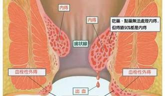 4.webp