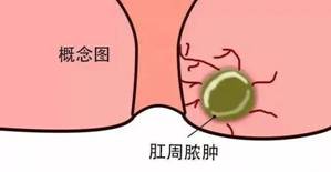 u=2256615866,1345172756&fm=253&fmt=auto&app=138&f=JPEG.webp