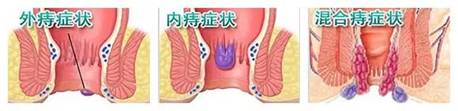 24.webp
