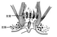 肛窦.webp