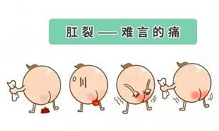 肛裂.webp (2)