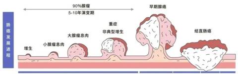 广州东大肛肠医院正规贫血、腹痛......这5个迹象，劝你最好做下筛查